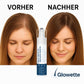 Glowette® Haarwachstum Roll-On